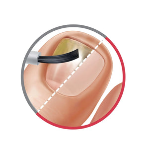 Pack Traitement Sérum Purifiant - 2 x 8ml - Poderm Professional - My Podologie